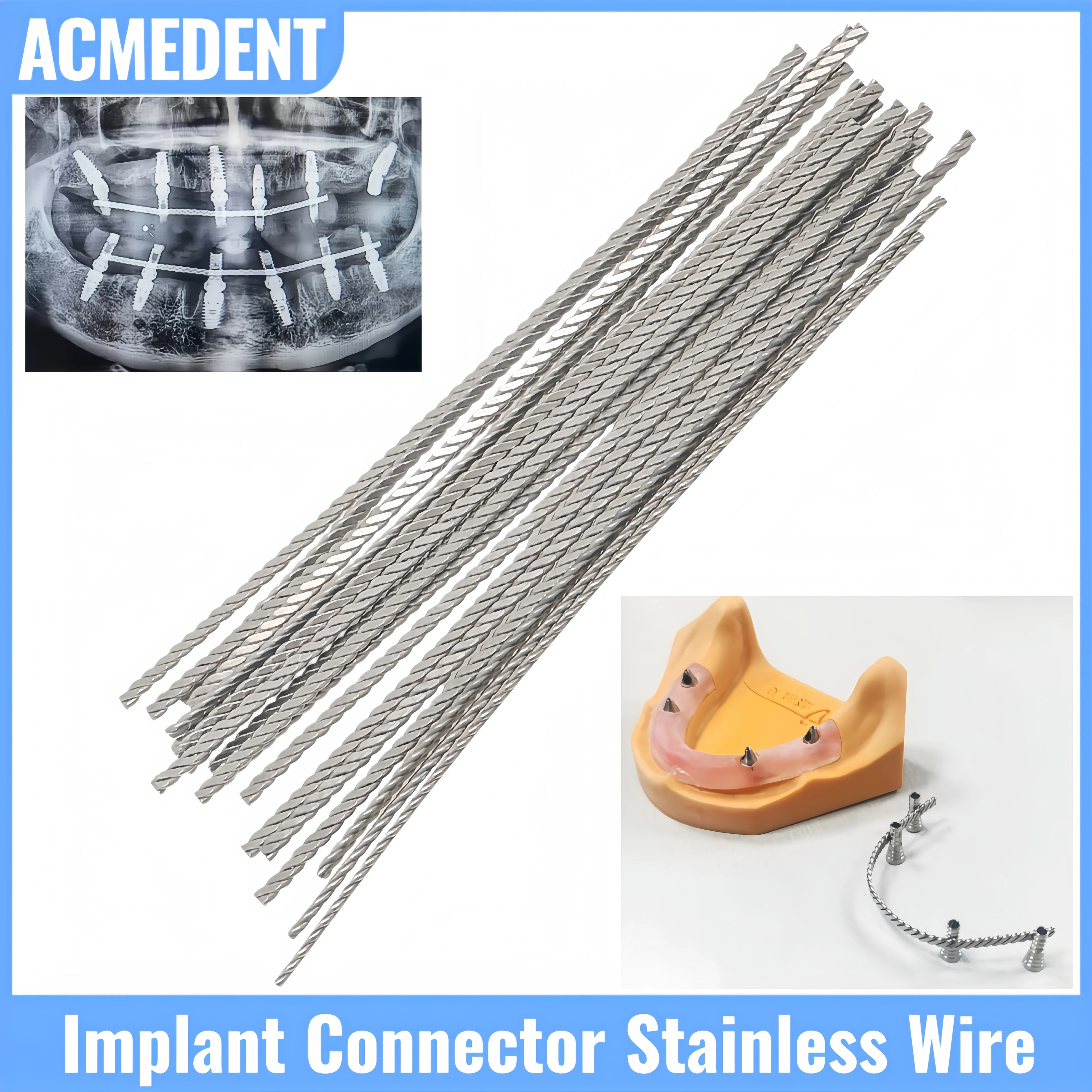 

5-100Pcs Dental Implant Connector Stainless Wire Strengthener Twist Wires Strengthening Wire For Retained Overdentures MU