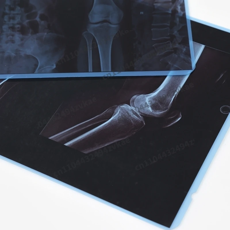 A4 A3 Size Medical Film, Radiology, Laser Printed Film, Inkjet Blue Film, Dental CT Fracture, DRCR X-Ray, MR Magnetic Resonance