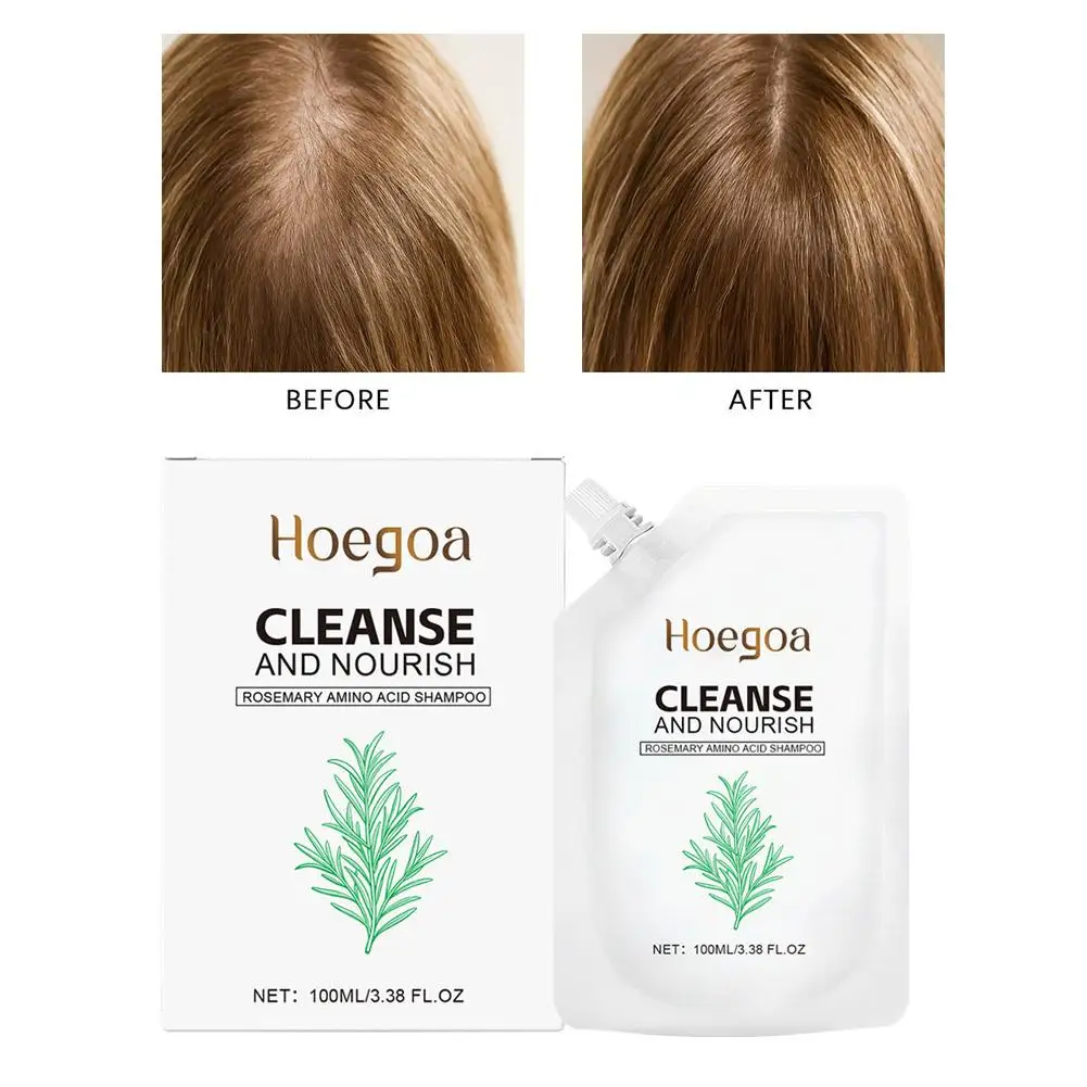 Shampoo aminoácido de alecrim, limpeza profunda do de da óleo, fortalecimento o controle anticaspa, nutre couro raiz, cabel U4L6