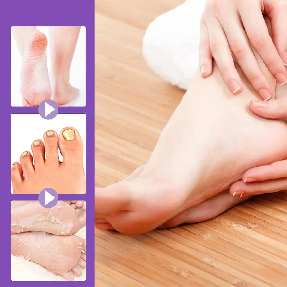 Sadoer pés máscaras esfoliantes pedicure meias esfoliação esfrega para pés máscara remover pele morta calcanhares pé peeling máscara 1 par