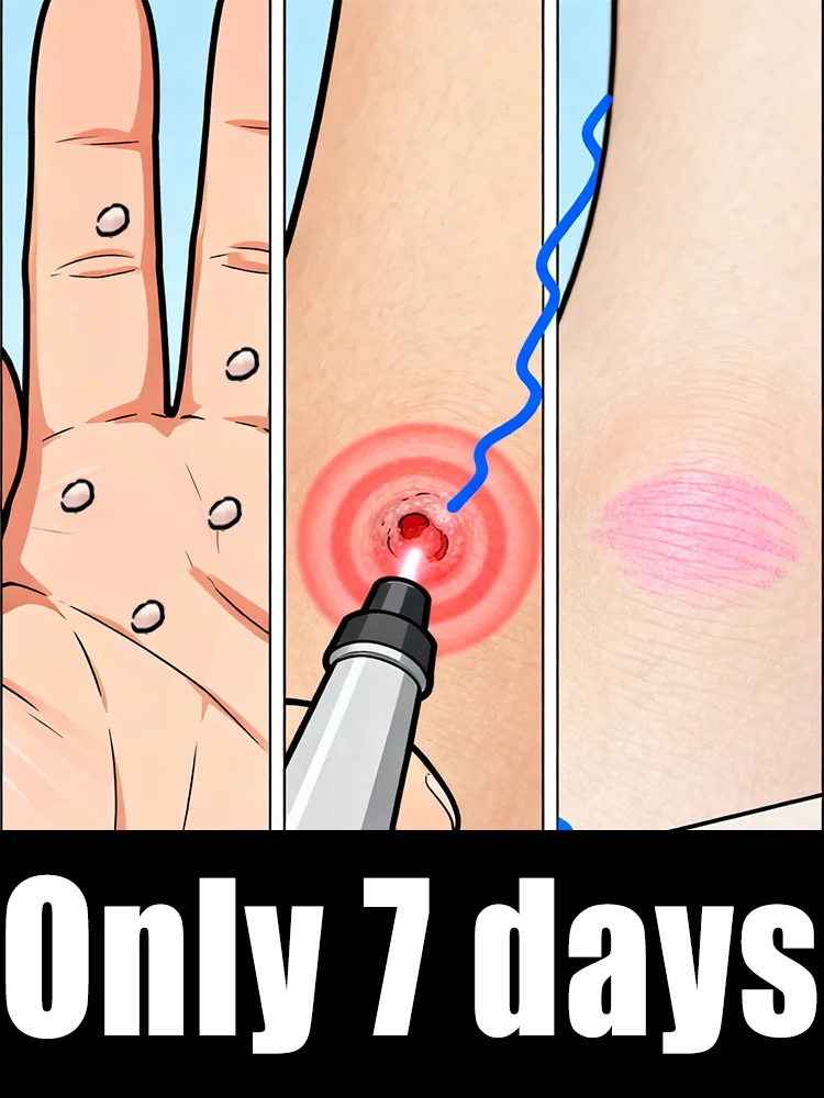 

Hᴏᴛ sᴇʟʟɪɴɢ ʙʟᴜᴇ ʟɪɢʜᴛ ᴘᴇɴ ᴛᴏ sᴏʟᴠᴇ ʙᴏᴅʏ ᴡᴀʀᴛs, ᴡᴀʀᴛ ᴄᴀʀᴇ ᴛᴏᴏʟs