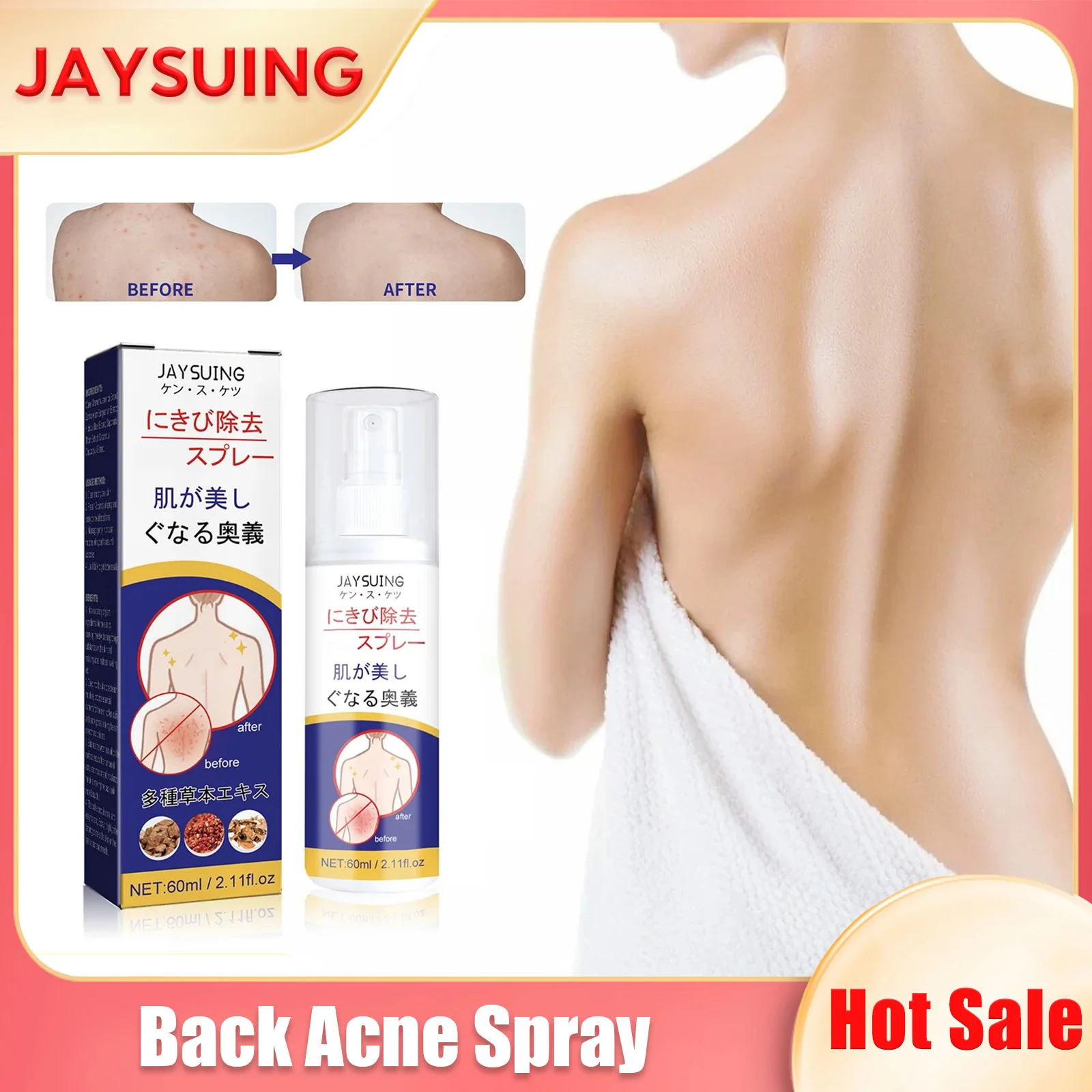

Back Acne Treatment Spray Moisturizing Repair Sooth Remove Whiteheads Blackheads Oil Control Shoulder Body Pimples Remover Spray