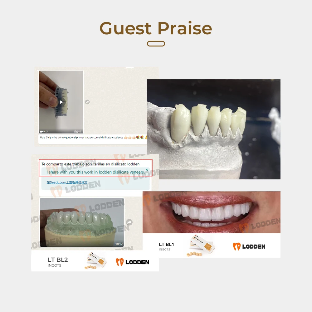 LODDEN 10 Stück Lithiumdisilikat-Pressbarren für Dental-Glaskeramik-Pressverfahren für ultradünne Veneers, minimalinvasive Reparatur HT/LT – Detail 9