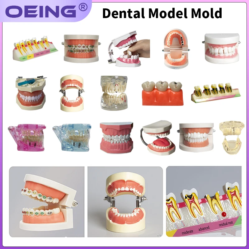 1Pcs Dental Communication Model Dental Teaching Model Removable Resin Denture Tree Dental Product Demonstration