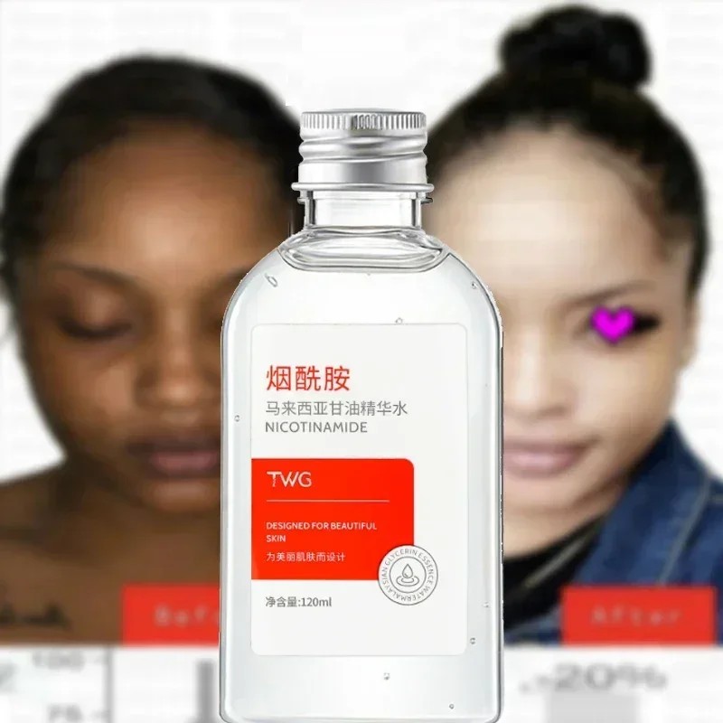 Niacinamide Malaysian Glycerin Liquid Brightens Skin Tone and Relieves Dryness Essence Hydrating Essence Milk