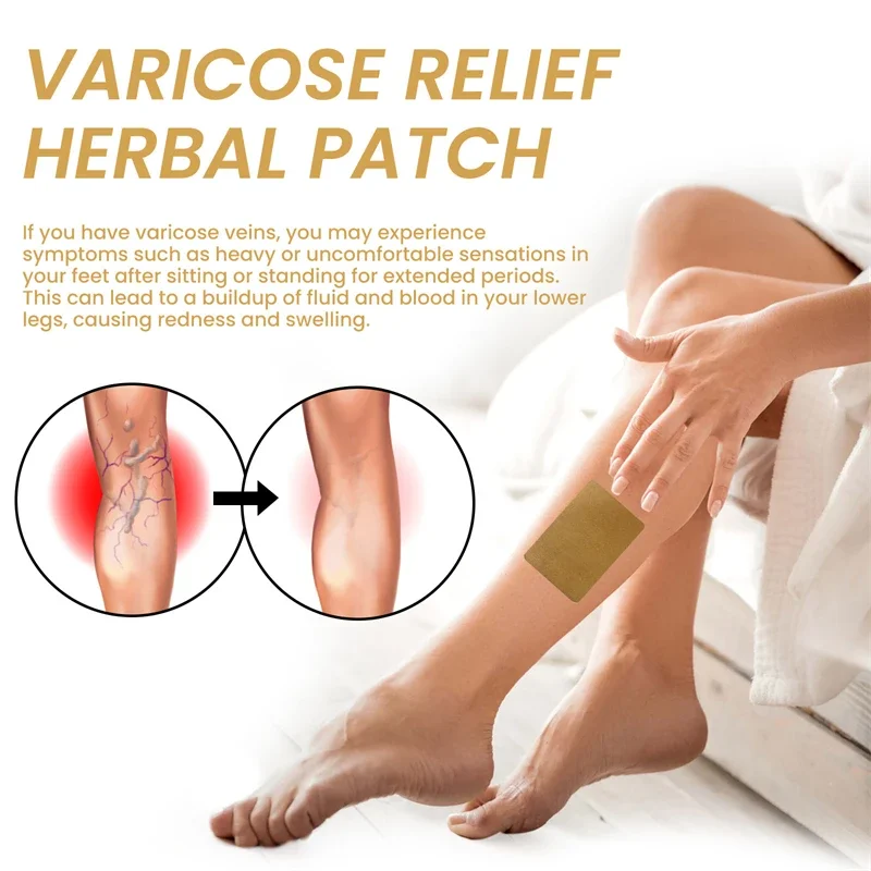 12pcs Varicose Vein Repair Patches Effective Relieves Leg Bulge Pain Treatment Sticker Vasculitis Phlebitis Remove Spider Veins