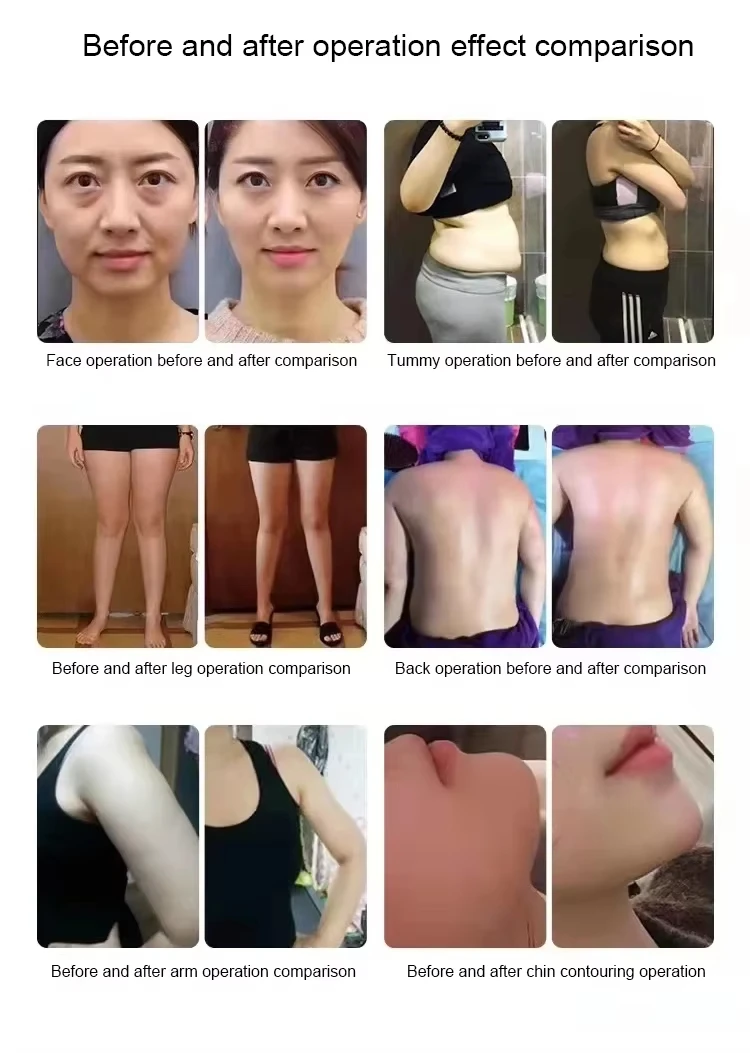 

Ret Physiotherapy Machine Tecar 448Khz Indiba High Radio Frequency Physical Therapy Device Portable Diatermia Pro Weight Loss