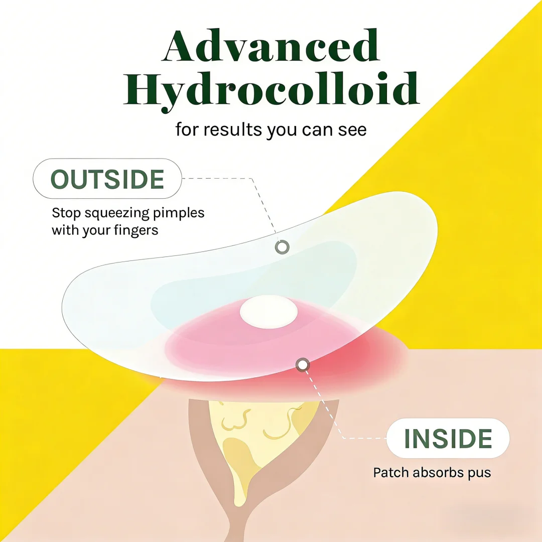 360 Adesivos Redondos de Hidrocoloide para Acne - Impermeáveis, Respiráveis, Suaves | Transparente Diário/Pré-maquilhagem | Viagem e Festa | Todos os 
