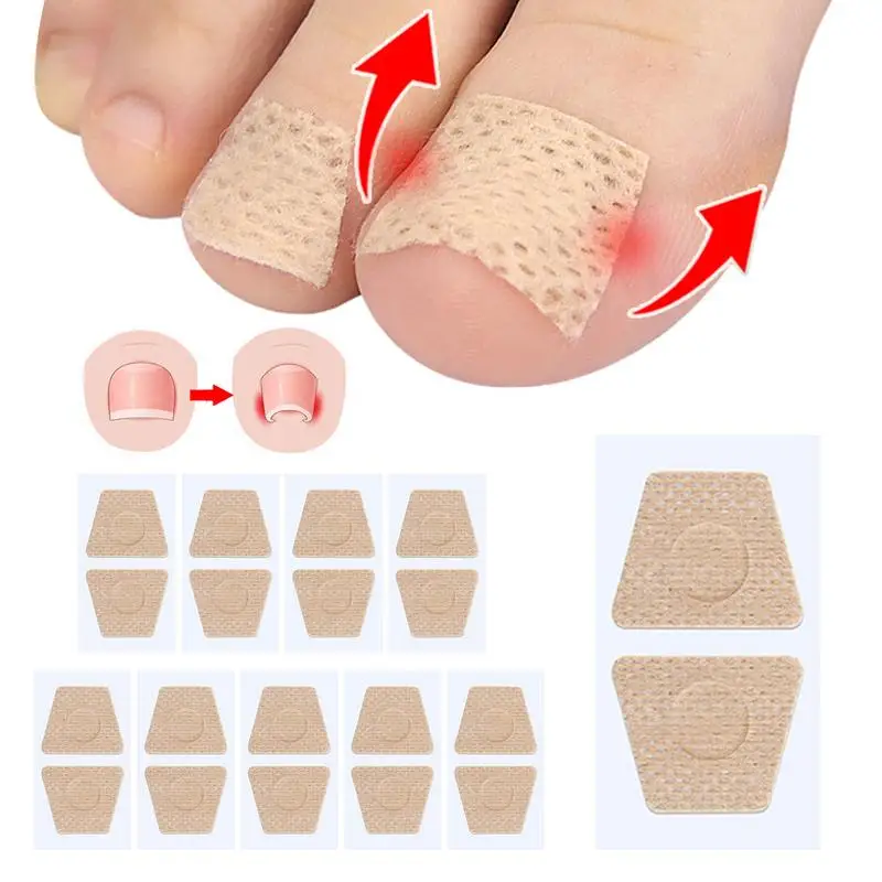 10 Stuks Teennagel Correctie Patch Nagel Vernieuwing Stickers Nagelreparatie Patches Voor Voetverzorging Gebroken Nagels Behandelingen Voetverzorging