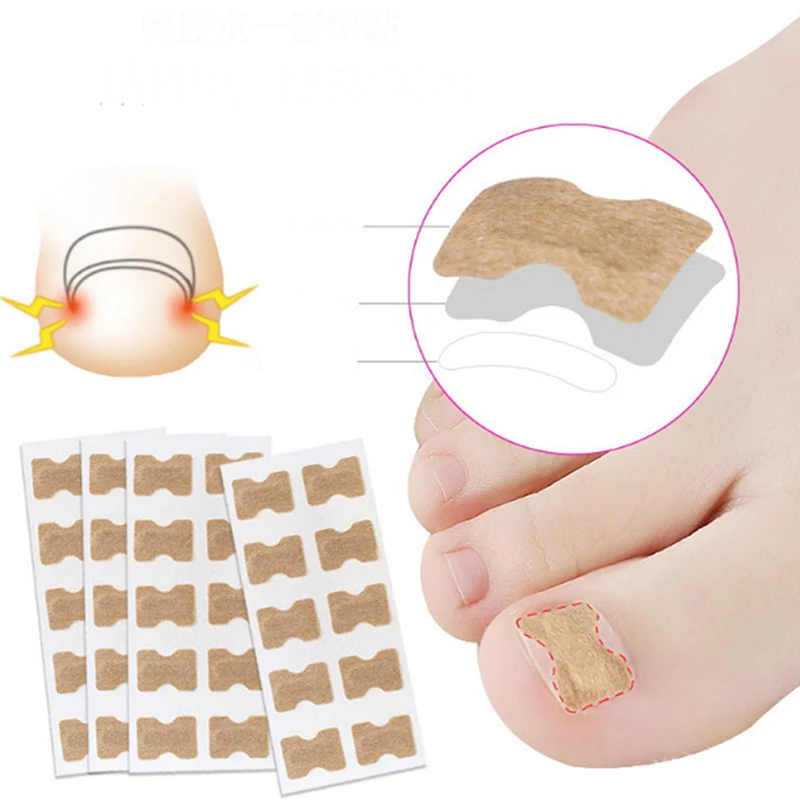 

10pcs/sheet Ingrown Toenail Correction Patch Self-Adhesive Foot Care Acronyx Toenail Brace For Paronychia Pedicure Tool Paster