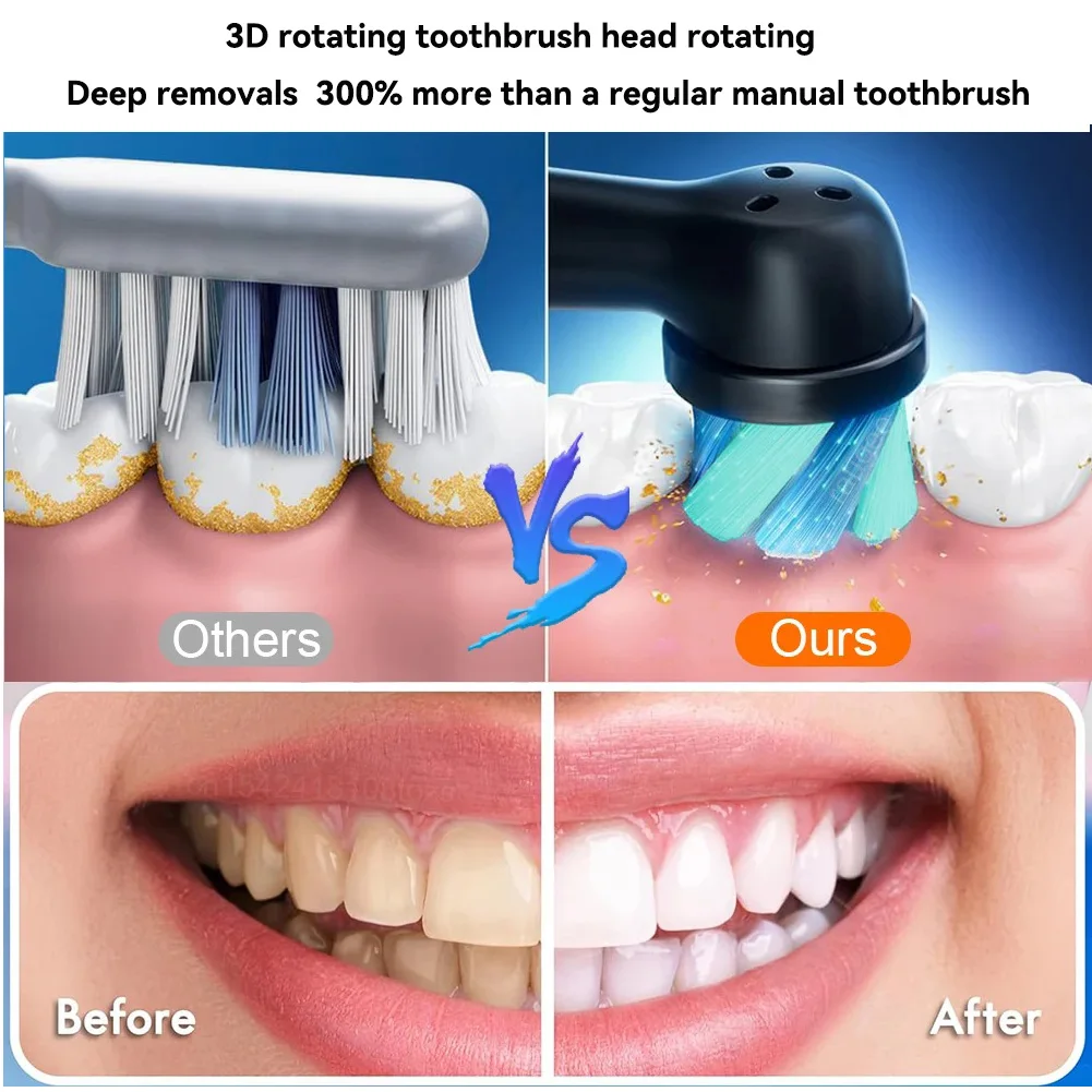 Roterende elektrische tandenborstel Zwart Wit voor volwassenen met 4 opzetborstels Diep schoon met oplaadbare kracht en 2-min. slimme timer
