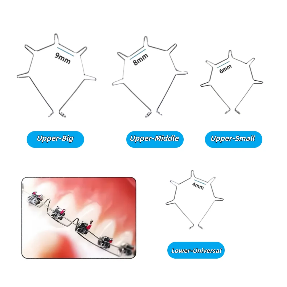 50/20/10Bags Dental Orthodontic Five Curved Anterior Teeth Torque Springs Big/Middle/Small Teeth Root Torquring Dental Materials