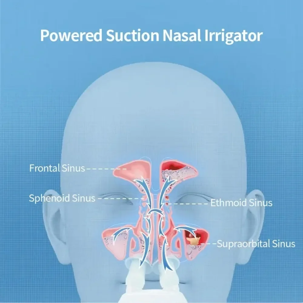 Electric Irrigador Nasal Nose Washer Negative Pressure Double-head Cleaner Nose Nursing Allergic Rhinitis Sinusitis Treatment