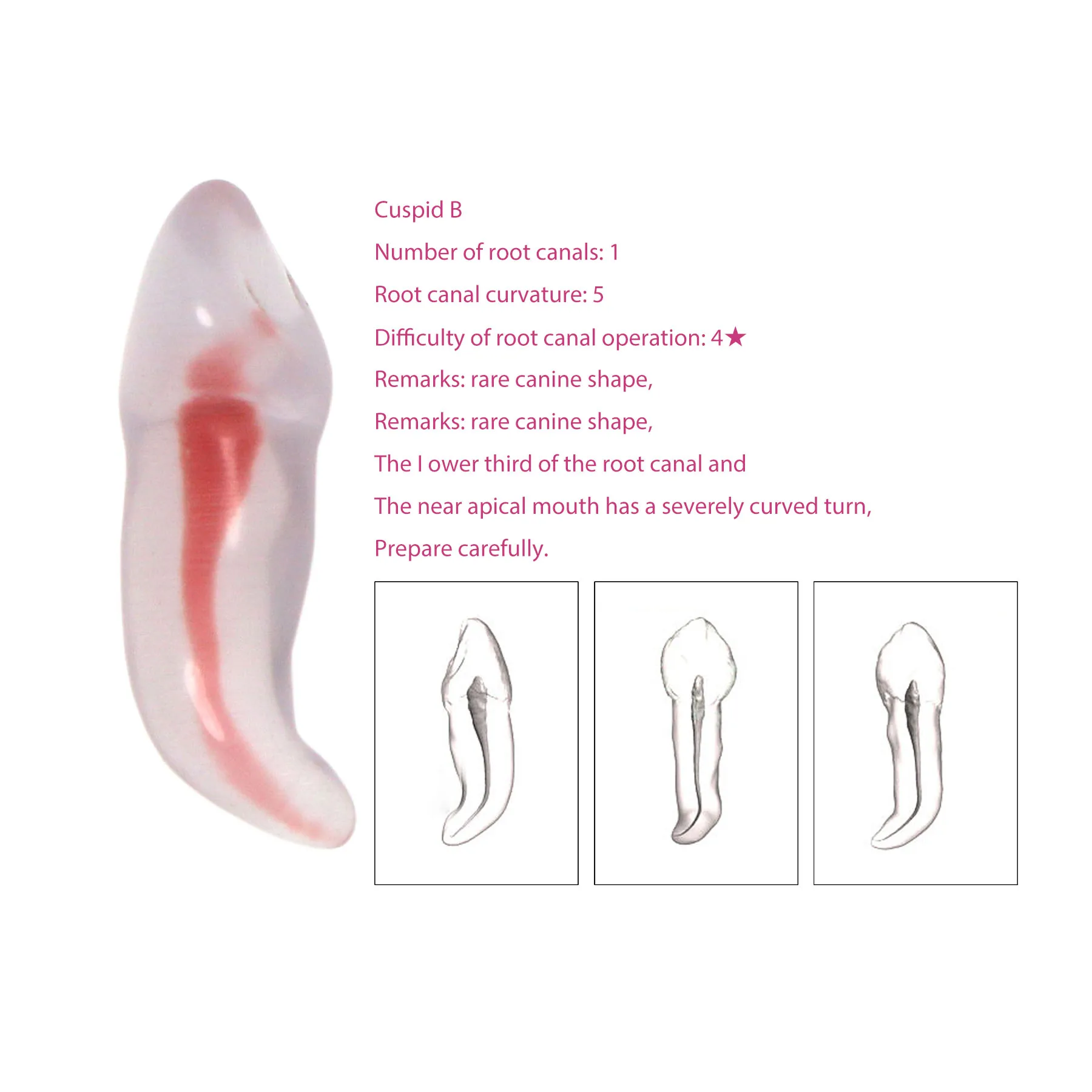 

Cuspid B Dental Root Canal Model 3D Practice Model Root Canal Therapy Resin Model Endodontics RTC