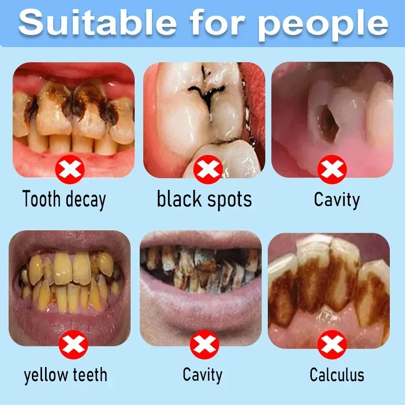 Riparazione della carie dentifricio sbiancante alito cattivo fresco carie Anti-cavità rimuovere la placca mal di denti alleviare la parodontite