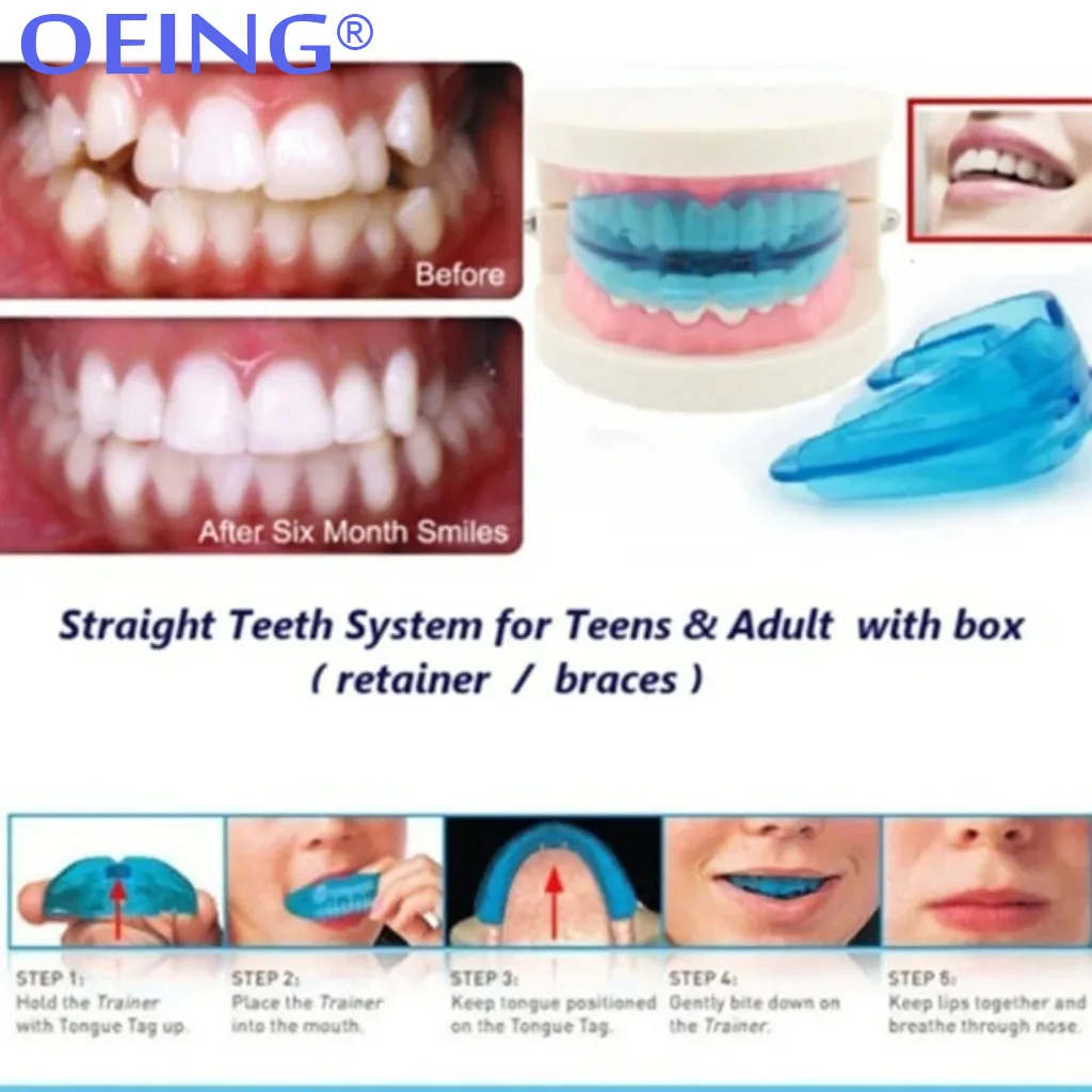 Thumbnail 3 - #31 Trending Dental Mouthguards Right Now