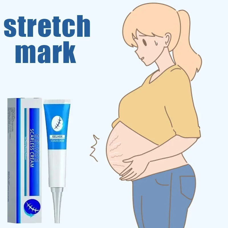 HOT SALE Stretch Mark Repair Moisturizer Gel Face Body Skin Beauty Care Stretch Mark Removal Cream Anti-wrinkle Skin Repair Crea