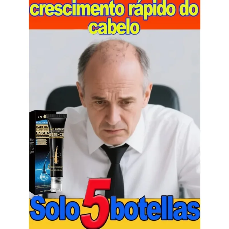 

[Официальный подлинный продукт] 99% покупать, больше и больше волос, попрощайте облысение, горячий продукт