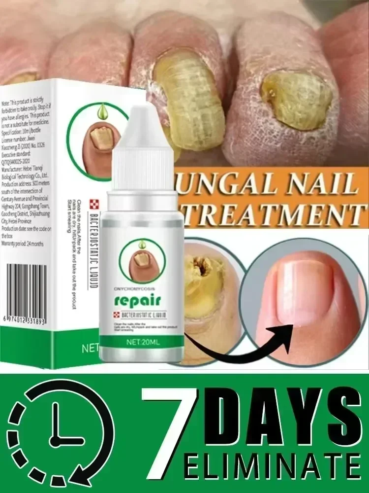 Toenail Nail Fungus Treatment Repair Fingernail Device Toenail Treatment for Foot Nail Fungus Essential Oil Onychomycosis Care