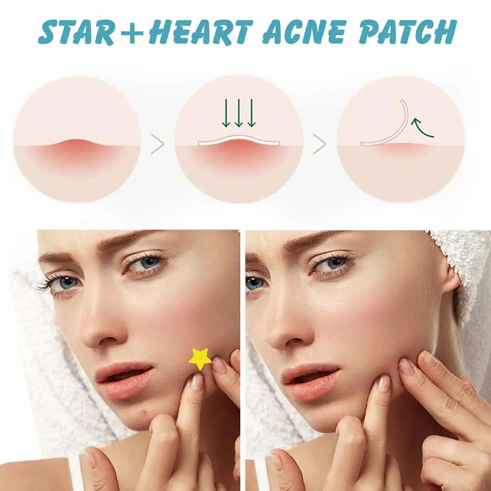 Hydrokoloidowe plastry na trądzik z motywem zwierząt z kreskówek, niewidoczne, usuwające wypryski, wodoodporne, korektor do przebarwień, naprawcze naklejki, pielęgnacja skóry.