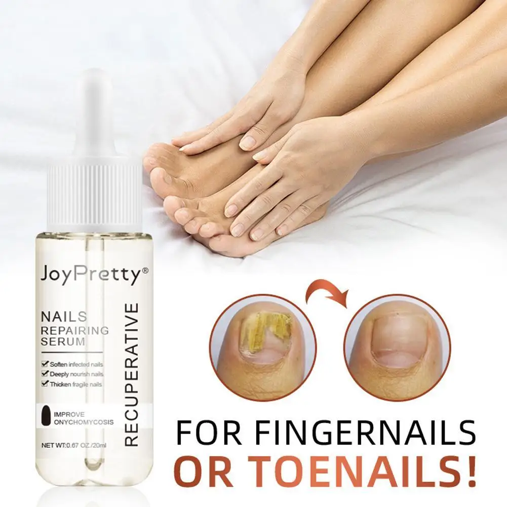 20ml Repairing Serum Nails Repairing Serum Toenail From Discoloration Nail Nails Nourishing Serums 7 Day Protects N4t2