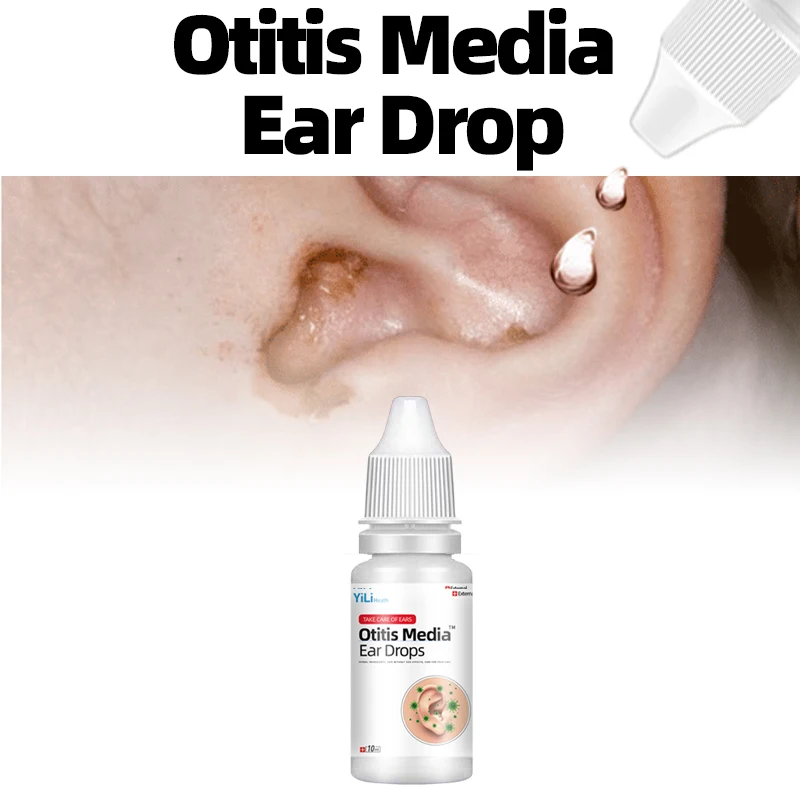 

Otitis Media Treatment Otitis Bacterial Infection Ear Drop Ear Itching Pain Acute Relief Earwax Cleaner Remover Drops 10Ml