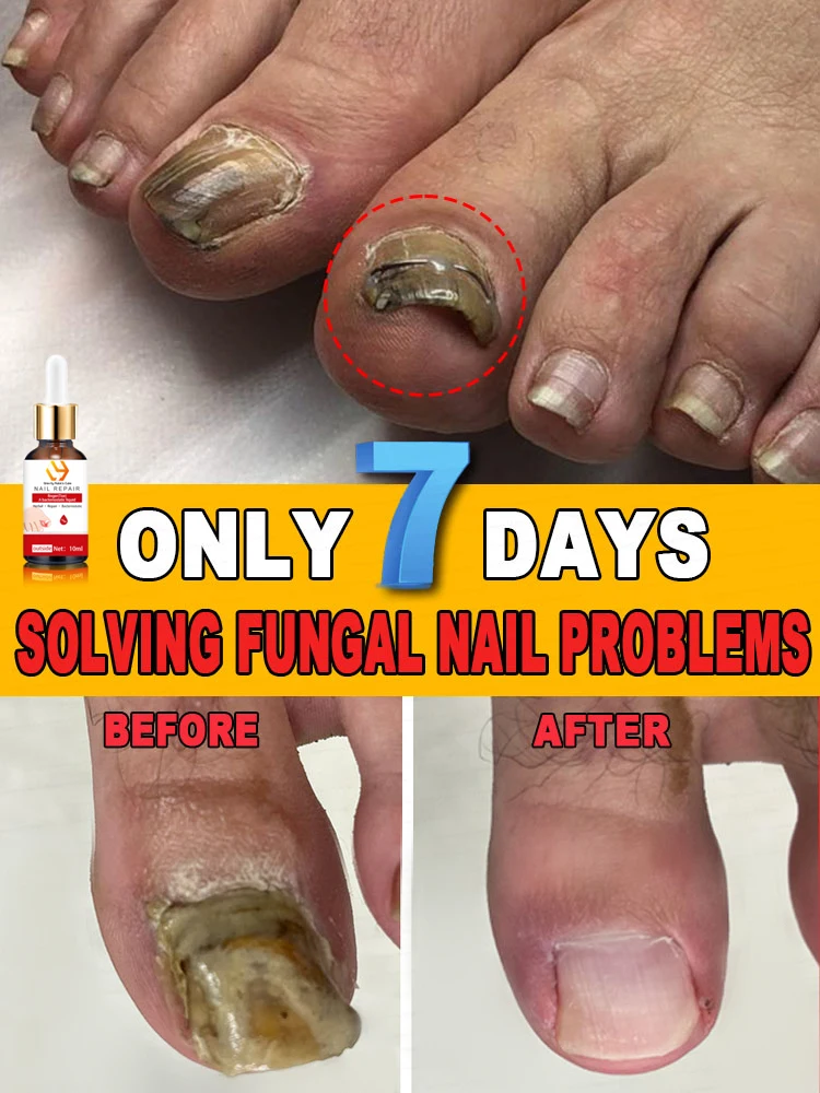 for solves nail troubles Products