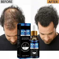 Effective Hair Growth Oil Rapid Repair Baldness Hair Follicles Hereditary Hair Loss Postpartum Hair Loss Seborrheic Hair Care