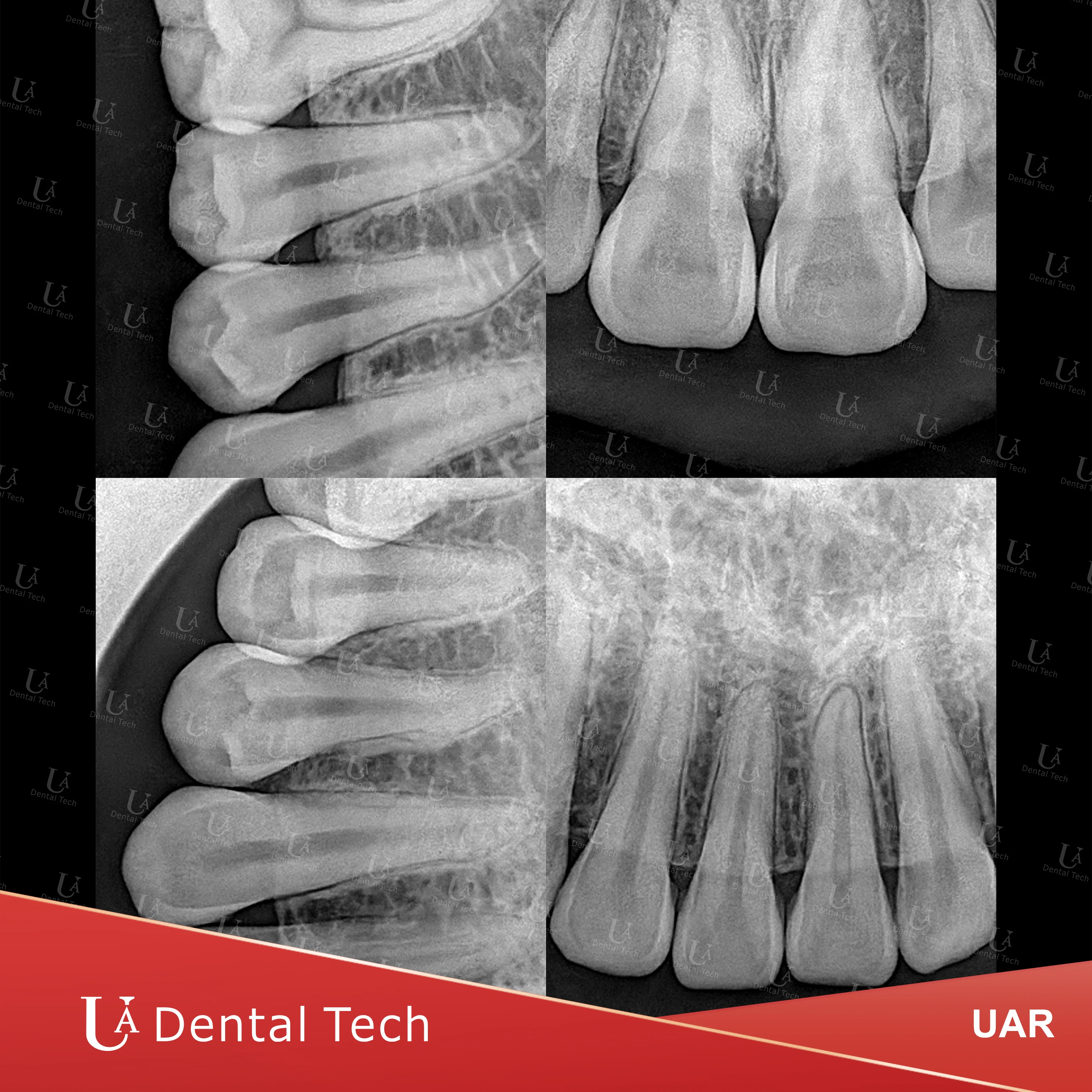 UAG-01 Blue Color Dental Equipment Digital Intraoral X Ray Imaging  X-ray Machine
