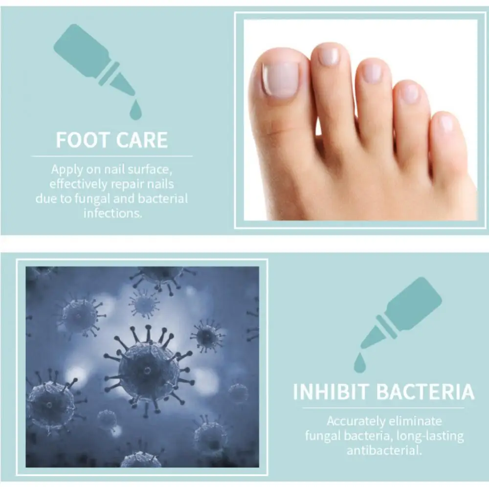15ml Fungal Nail Repair Serum Foot Toe Nail Fungus Atreatment Nails Gel Anti Paronychia Onychomycosis Nails Care TSLM2