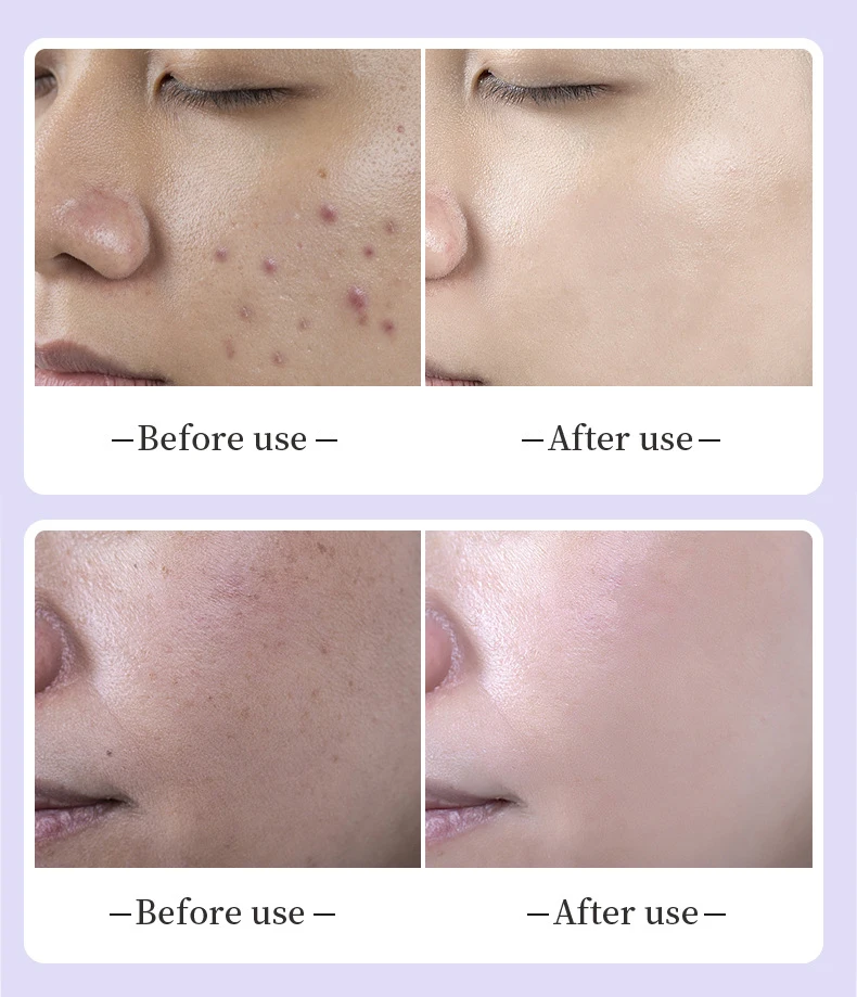 

7-цветная светодиодная фотонная машина, нано-спрей, увлажняющий крем для кожи, складной, с 3 уровнями для красоты