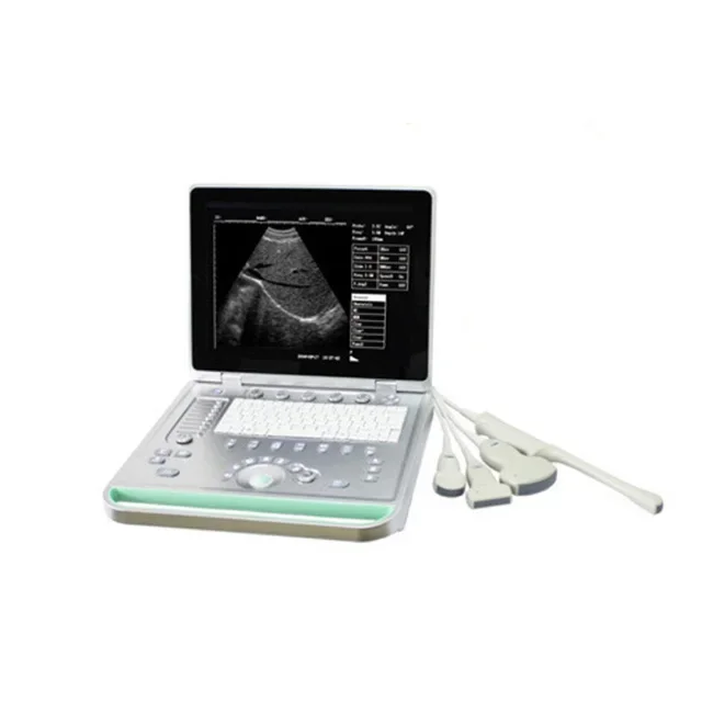 

Medical UItrasound Instruments Laptop Ultrasound Machine B/W Portable Ultrasound Scanner