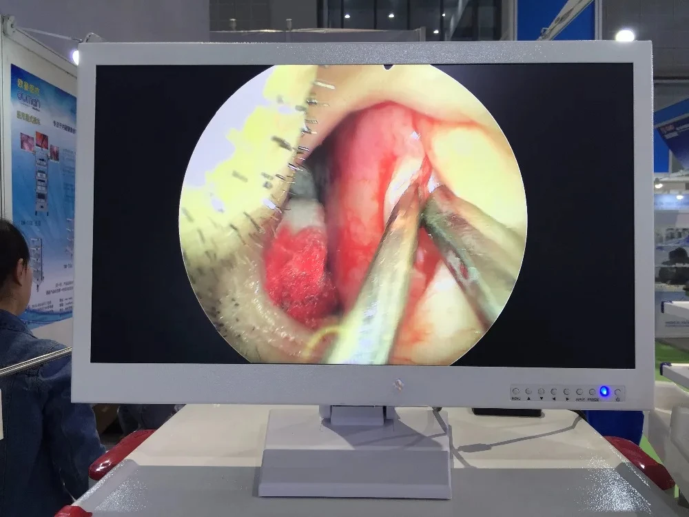 Made In China Minimal Invasive Surgery Medical Endoscope  Monitors