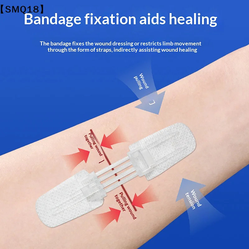 Zipper Wound Closure Patch for Minor Cuts