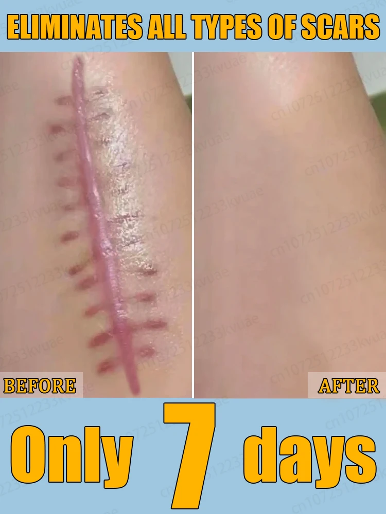 ᴱˡⁱᵐⁱⁿᵃᵗᵉ ˢᶜᵃʳˢ‧