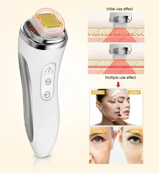 Electric Facial Lifting Device Dot Matrix Skin Tightening Facial Massage Home Beauty Equipment Beauty Device