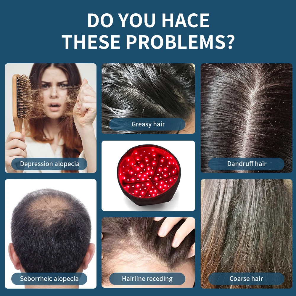 

Шапка-головной убор для светотерапии красным светом и ближним инфракрасным излучением LED для лечения роста волос, предотвращения выпадения, расслабления кожи головы и облегчения состояния.