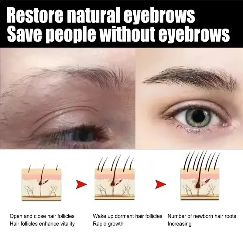 Soro de crescimento rápido de sobrancelha, crescimento de cílios, produto anti-perda de cabelo, prevenção de calvície, alongamento mais grosso, maquiagem de sobrancelha
