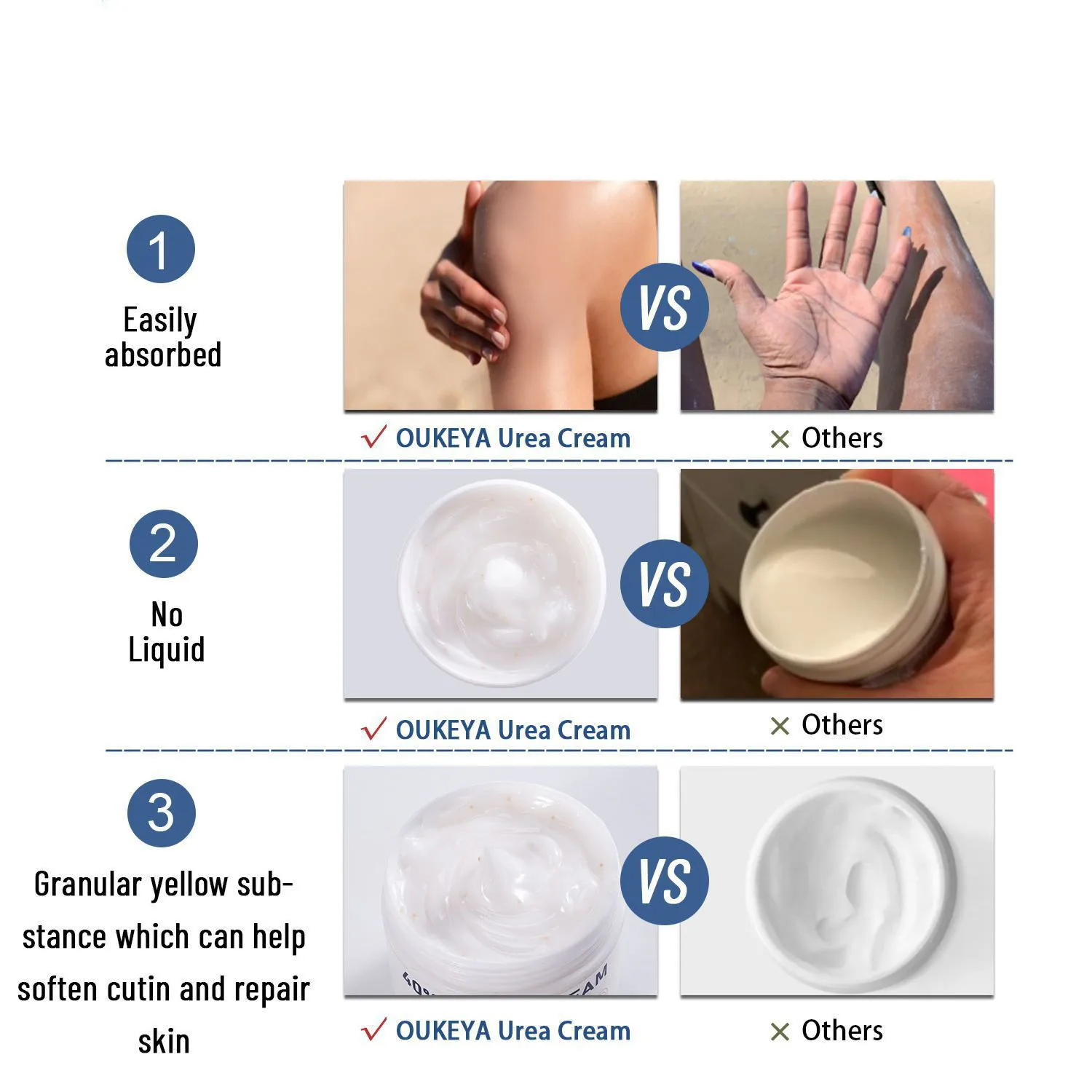 كريم اليوريا 42% كريم اليوريا لتجفيف وترطيب كريم اليدين والقدمين للبشرة الجافة، تقشير وتخفيف الحكة 100 جرام/زجاجة