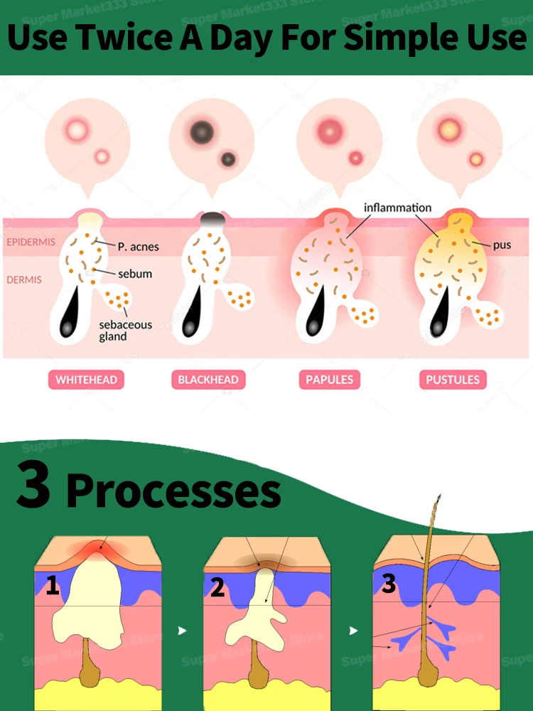 Don’t be afraid of small red spots or bumps on your face, skin care products