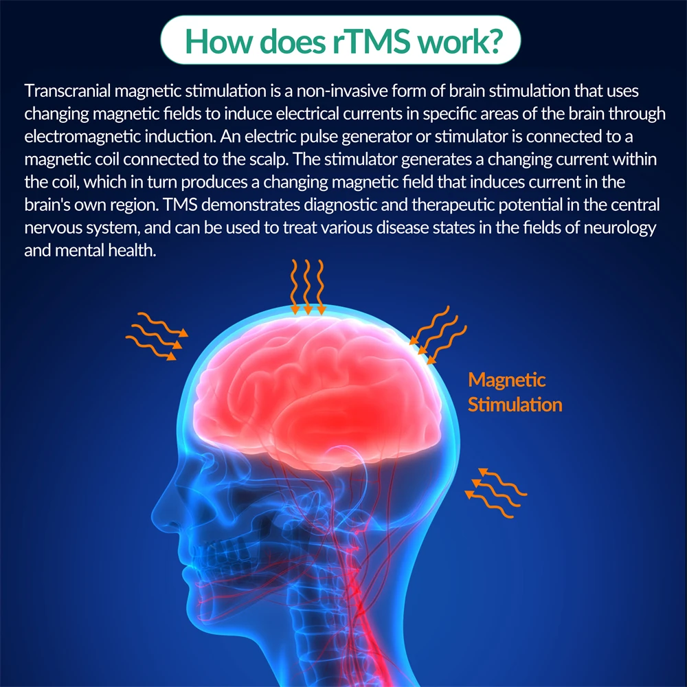 ZJKC rTMS Transcranial Magnetic Stimulation Therapy Device for Anxiety Chronic Depression Treatment Protect Brain Tissue