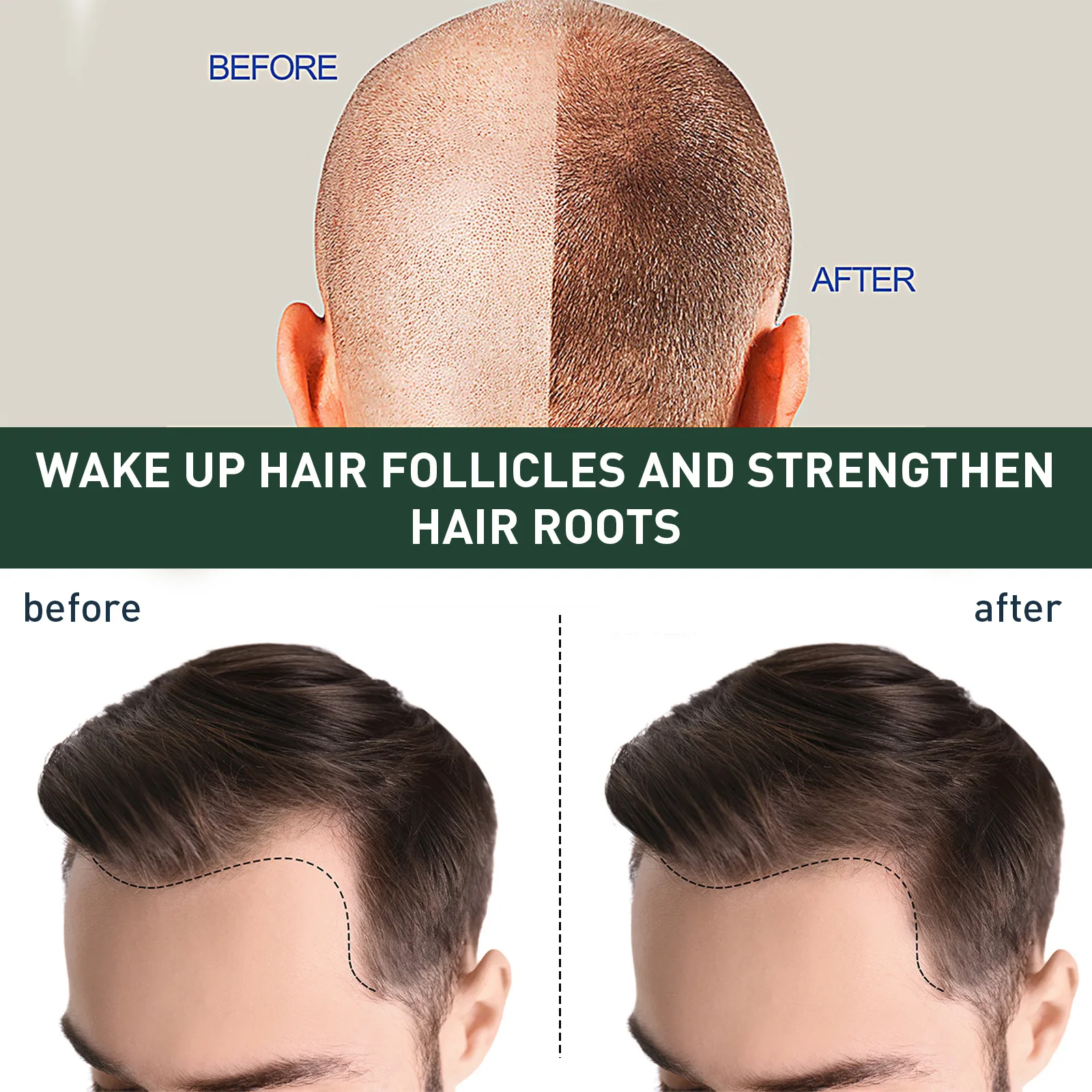 Hair Growth Serum Baldness Treatment Repair Hereditary Hair Follicles Regrowth Beard Thicken Nourishing Anti Hair Loss Essence