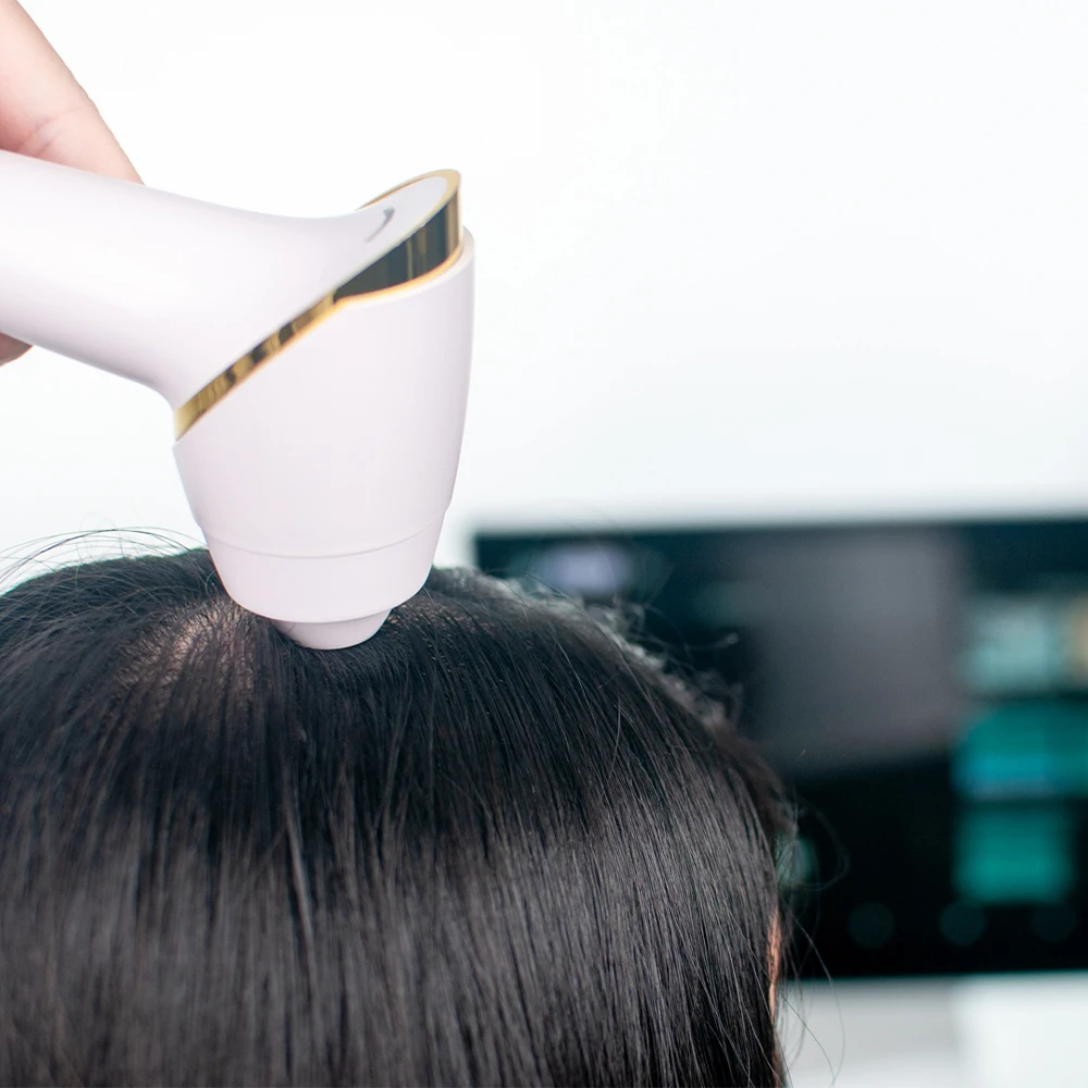 Scalp Skin Hair Analysis Machine, High-Definition Camera, Pigmentation Inflammation Detection, Dermatoscope Tool