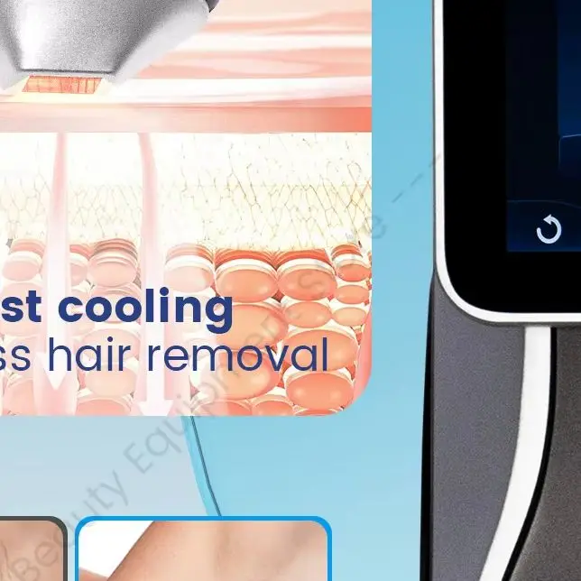 Diode Laser Hair Removal 5000W Ice Painless 3 Wavelength 755 808 1064nm Semiconductor Full Body Hair Removal Device