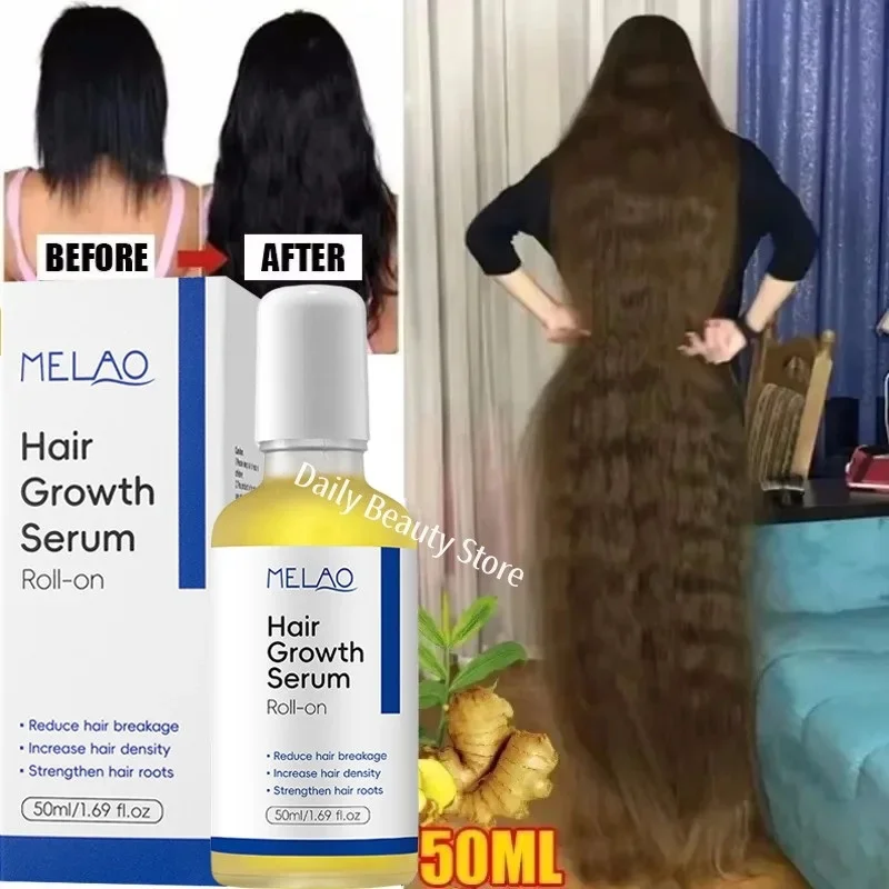 

Fast Hair Growth Serum 8 Days Anti Hair Loss Prevent Baldness Scalp Treatment Repair Roots Beauty Health Hair Care For Men Women
