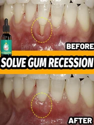 Save gums