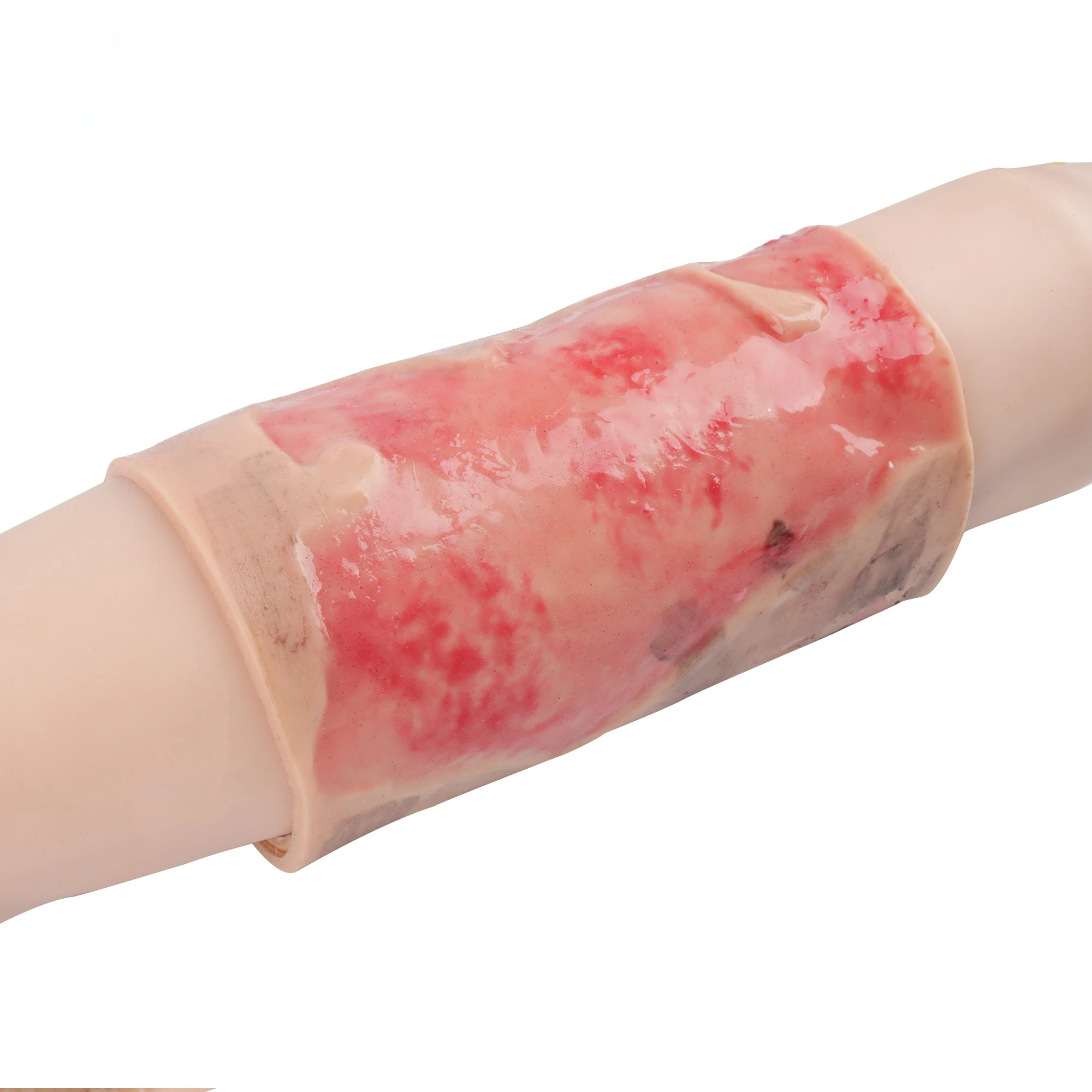 Silicone Burn Wound Limb Model, Nursing Trauma Training Teaching Module
