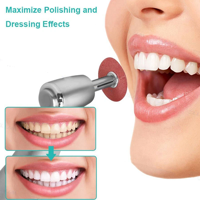 Dental Finishing Polishing Discs 50pcs Set for Dentist Composite Metal Polishing Reusable Autoclavable Design