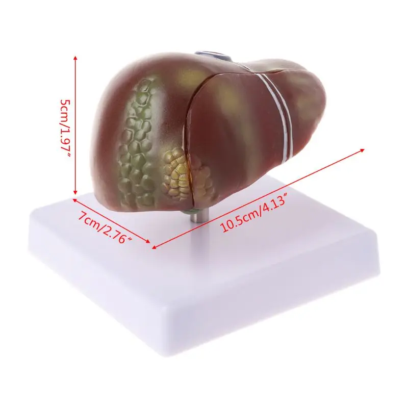 Human Liver Pathological Anatomical Model Anatomy School Medical Teaching Displa