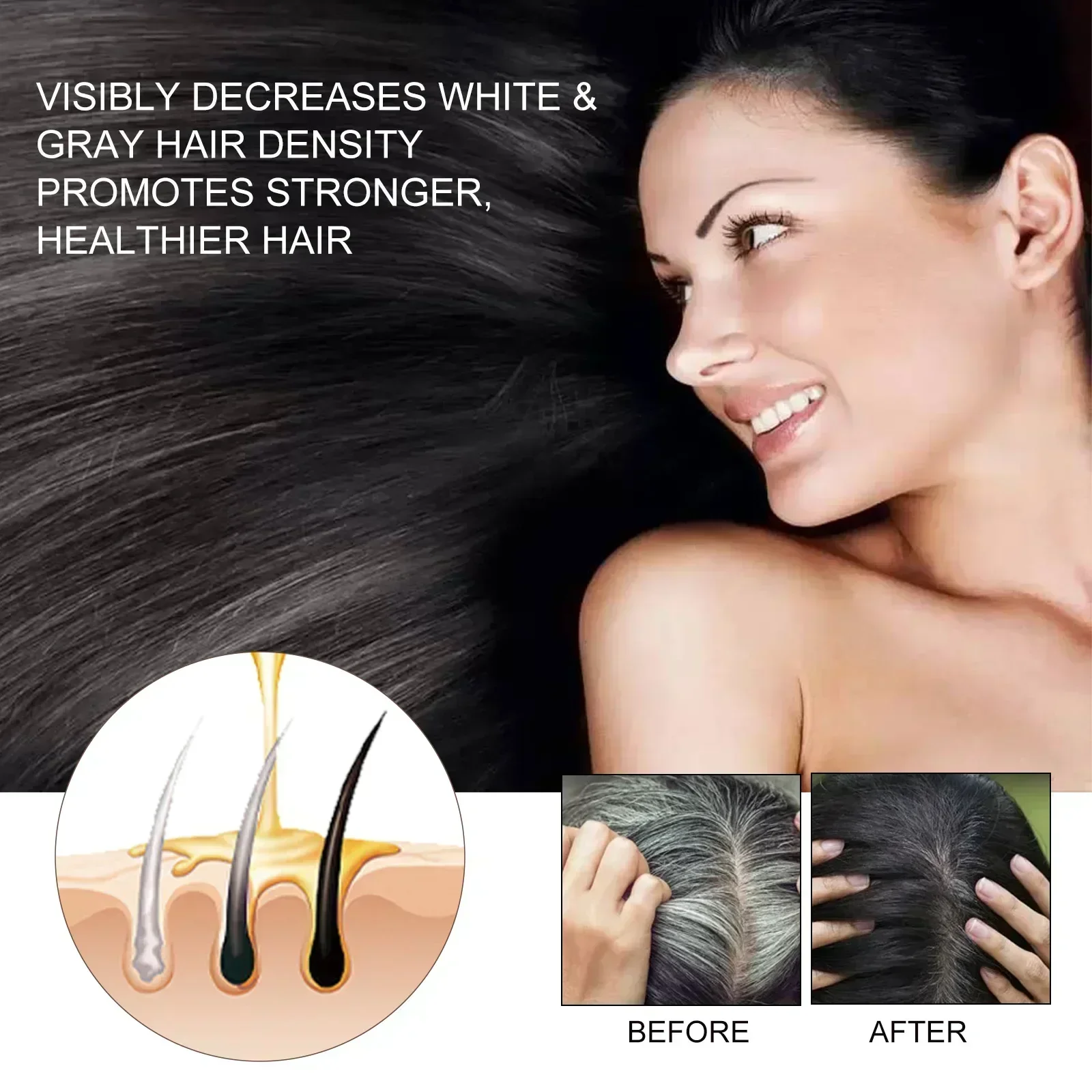 Hair Growth Essential Loss Regrowth Treatment Strengthens Hair Nourishes Scalp Light Weight Non Greasy Improve Scalp Circulation